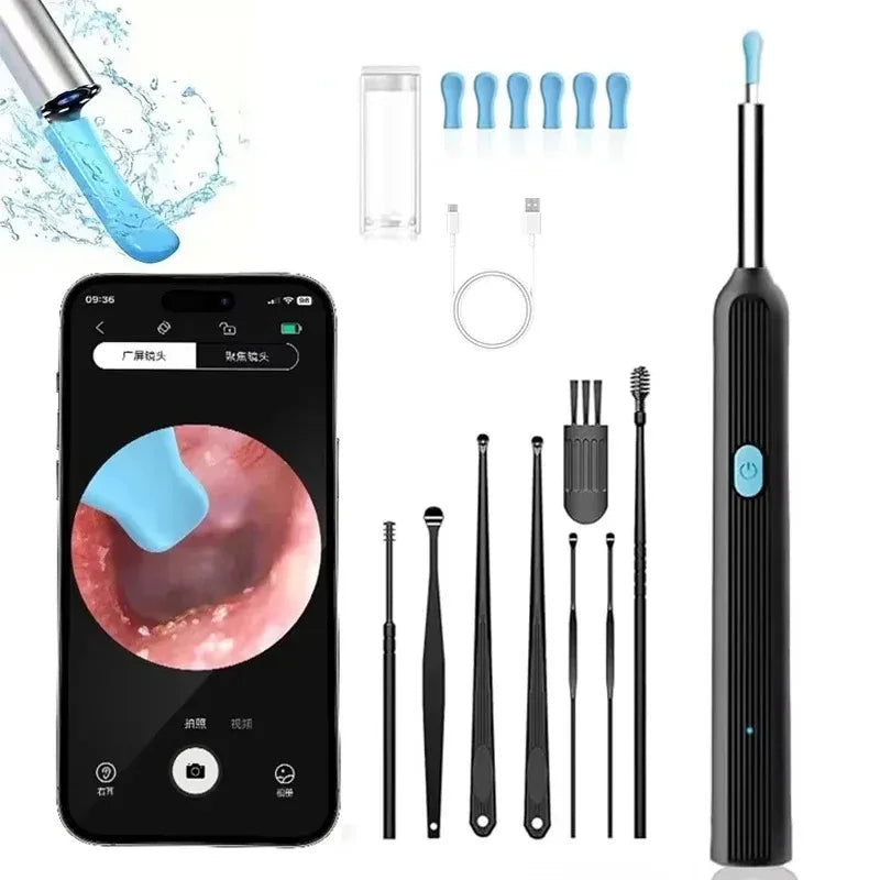 Set intelligenter Ohrreiniger mit Handgerät, verschiedenen Spitzen und Ladekabel neben einem Smartphone