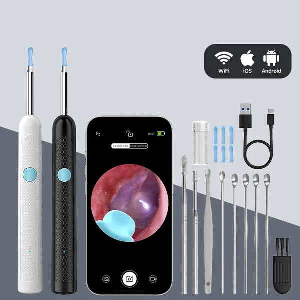A set of professional digital ear inspection cameras and various tools for examining the ear.