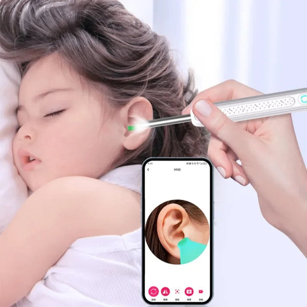 A hand uses a smart visual ear cleaner device to examine a child's ear.